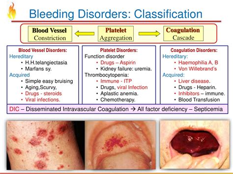 can be the result of a weakened blood vessel|Overview of Vascular Bleeding Disorders .